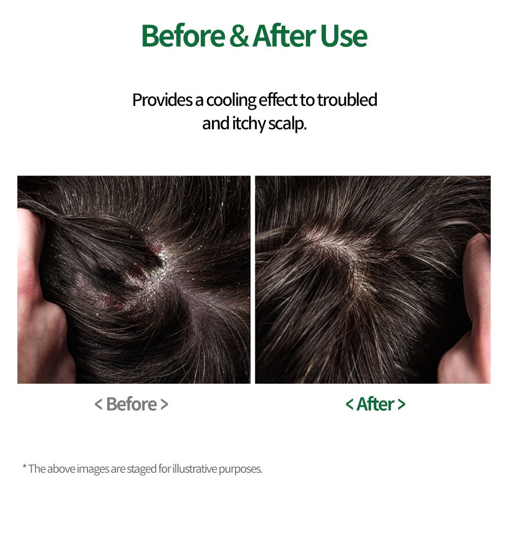 Yur Miracle Scalp Pack 250ml