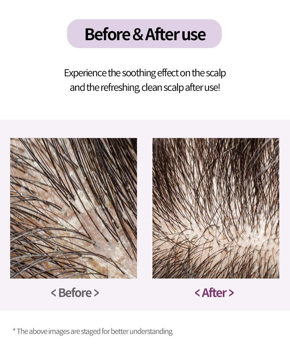 Yur Scalp Scaling Shampoo 450ml