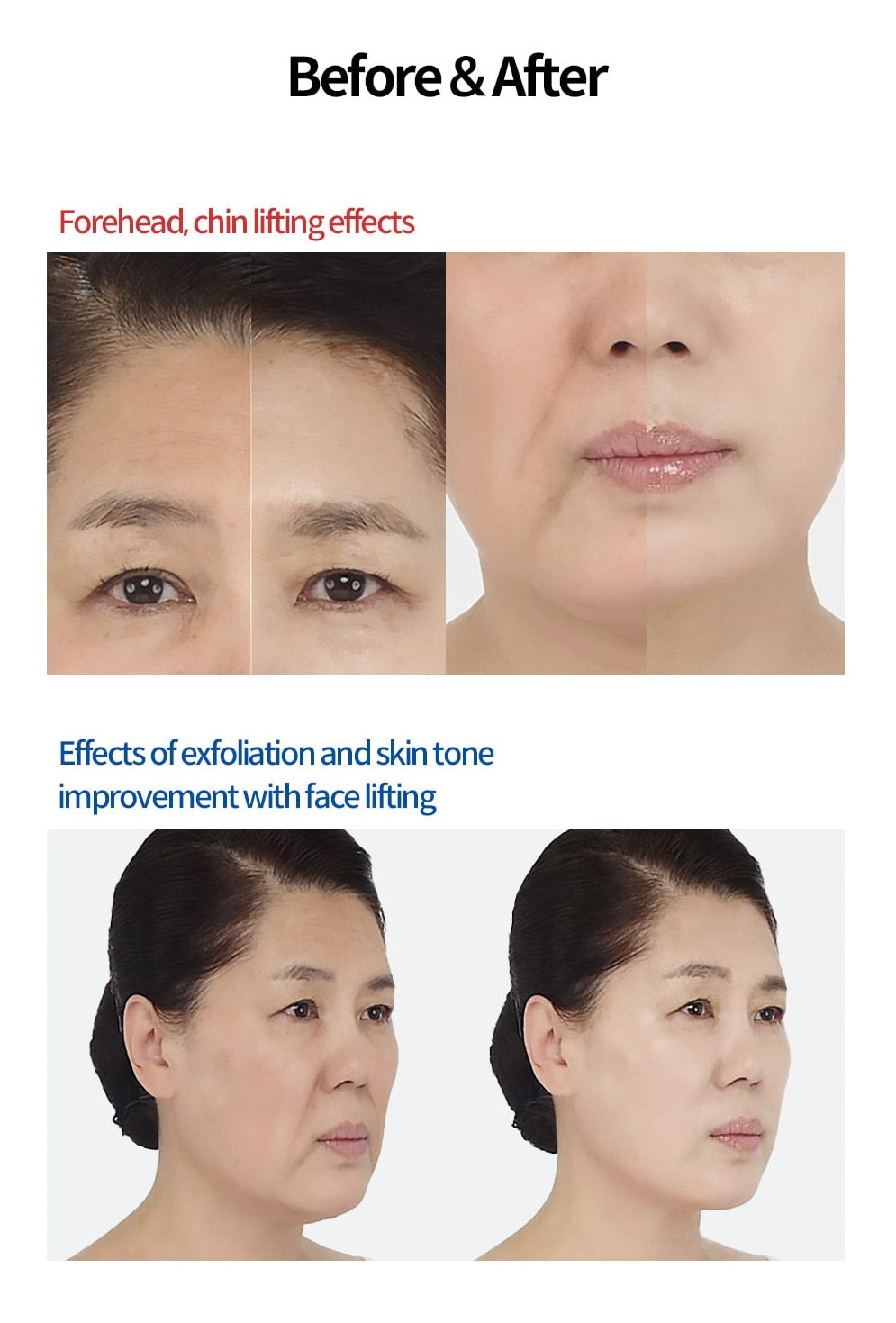 Yur Thread Lifting Mask & Serum